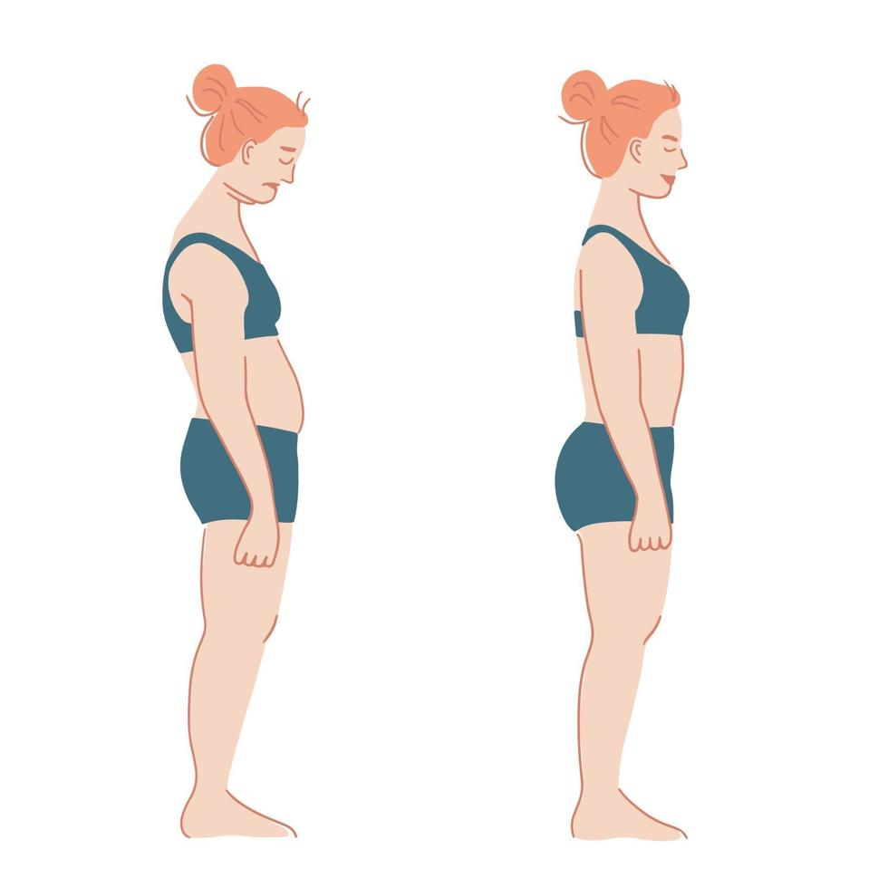 Posture Corrector